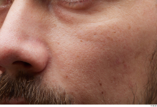 HD Face Skin Nigel cheek face nose skin pores skin…